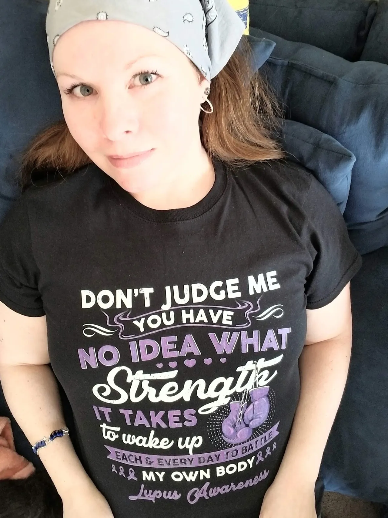 Woman in black shirt with Lupus awareness message.