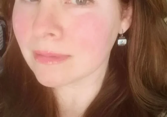 Woman with brown hair wearing an earring.